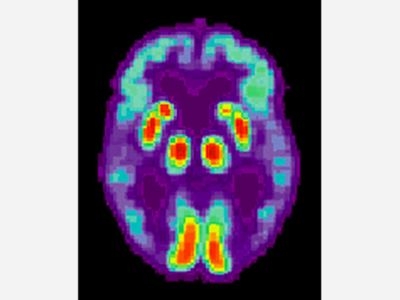 Cong. Auchincloss Co-Sponsors Alzheimer Detection Bill